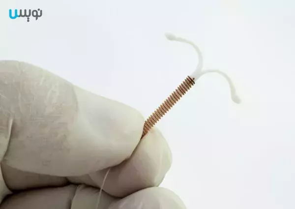 دستگاه داخل رحمی (IUD)